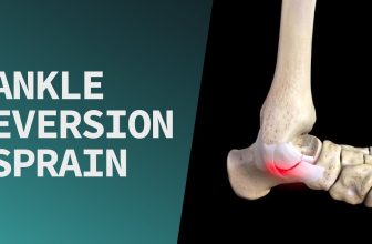 Ankle Eversion Sprain