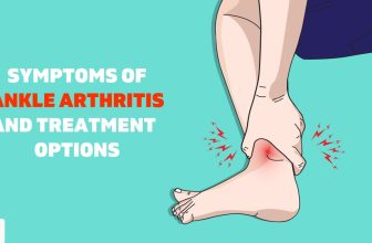 Don’t Ignore Your Ankle Pain: Understanding Ankle Arthritis
