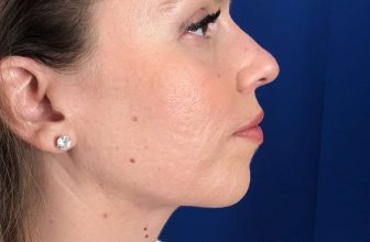 Radio Personality Bianca Fort – Holds Her Chin Up High