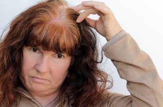 How Is Hair Loss Connected to Osteoporosis Drugs?