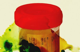 Thousands of Urine and Tissue Samples Are in Danger of Rotting After Staff Cuts at a CDC Laboratory