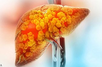Developing a Fatty Liver Increases Your Risk of Mortality