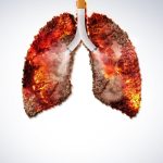 World,No,Tobacco,Day,2022-,Threat,To,Our,Environment.,Throughout