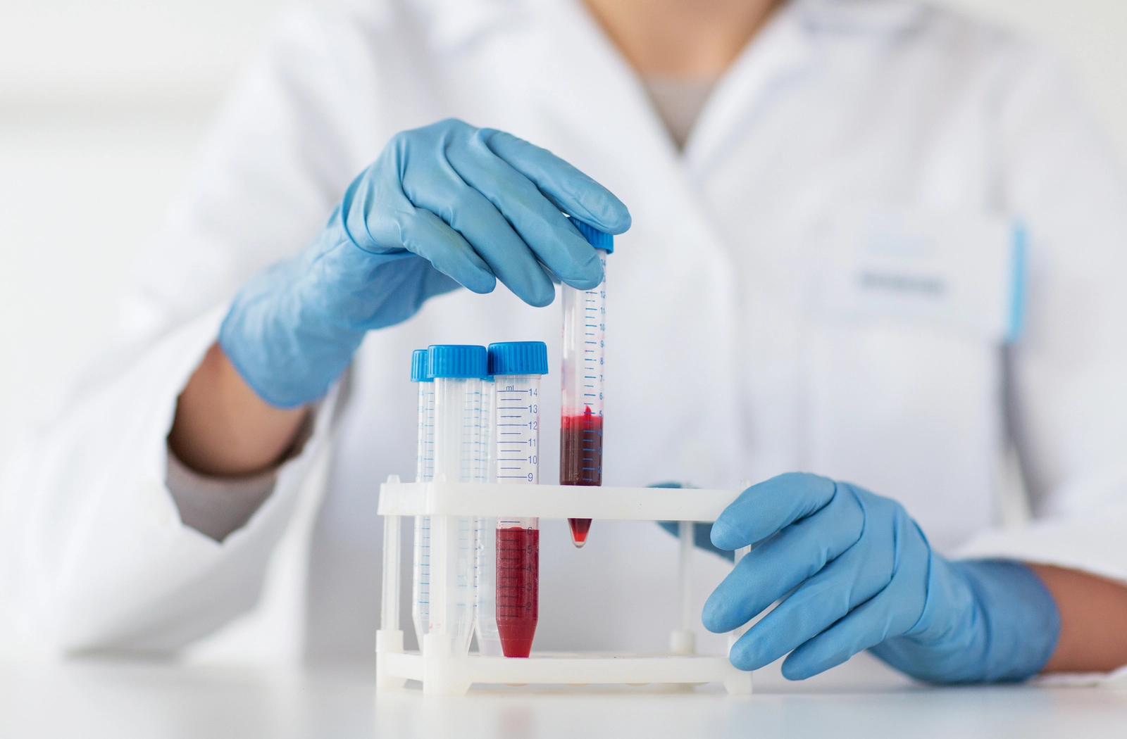 How Long Does a Blood Drug Test Take?