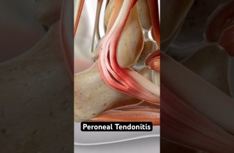Swollen ankle = tendon damage? (3D Animation)