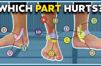 My ankle hurts here! 11 typical pain spots and what they mean