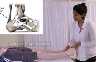 The Exam for Ankle & Foot Pain – Stanford Medicine 25