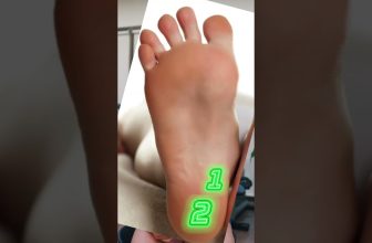 Not ALL heel pain is Plantar Fasciitis! #heelpain