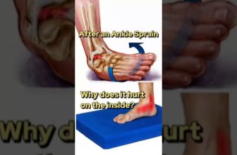 Medial Ankle Pain! #shorts