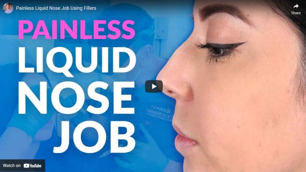 Liquid Nose Job with Facial fillers