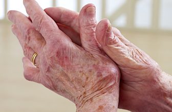 New evidence-based points to consider and consensus definitions for people with psoriatic arthritis