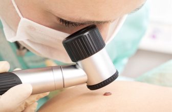 Early immunotherapy shows higher response in advanced basal cell carcinoma