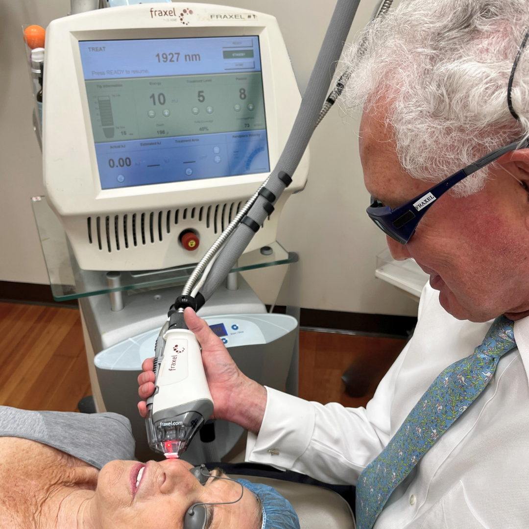 Dr. Dover treating a woman's face with Fraxel
