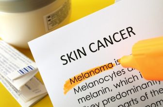Higher melanoma rates linked to agricultural areas in Pennsylvania