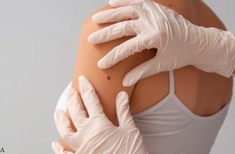 Niacinamide Found to Reduce the Risk of New Skin Cancers