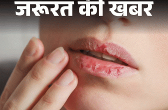 Winter Lip Crack; Prevention And Home Remedies | Health Care Tips | जरूरत की खबर- सर्दियों में क्यों फटते हैं होंठ: डर्मेटोलॉजिस्ट से जानें कारण और बचाव के तरीके, विंटर लिप्स केयर के 15 टिप्स
