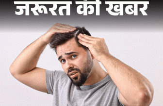 Winter Dandruff Problem; Home Remedy Treatment | Hair Scalp | जरूरत की खबर- सर्दियों में बढ़ती डैंड्रफ की समस्या: ठंड में न करें ये 10 गलतियां, डर्मेटोलॉजिस्ट से जानें विंटर केयर के 12 टिप्स