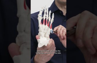 Could This Be The Cause Of Your Foot Pain?