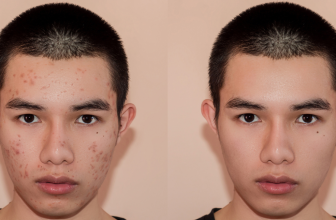 TheraClear: The Power of Pore-Cleansing Meets Light Therapy for Clearer Skin