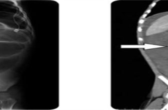 Official journal of the American College of Gastroenterology