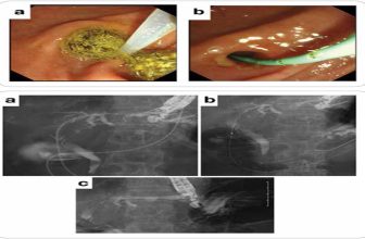 Official journal of the American College of Gastroenterology