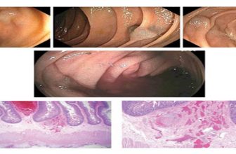 Official journal of the American College of Gastroenterology