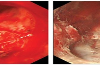 Official journal of the American College of Gastroenterology