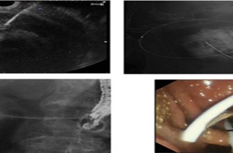 Official journal of the American College of Gastroenterology
