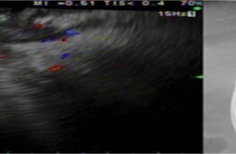 Official journal of the American College of Gastroenterology