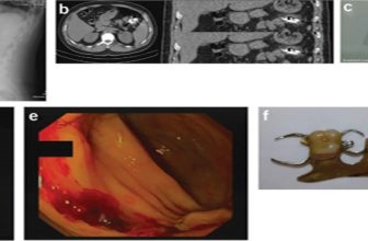 Official journal of the American College of Gastroenterology