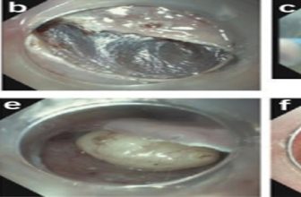 Official journal of the American College of Gastroenterology