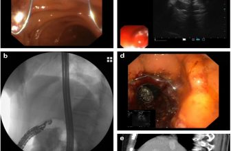 Official journal of the American College of Gastroenterology