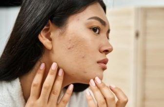 Effective Dermatologist-Recommended Treatments for Adult Acne