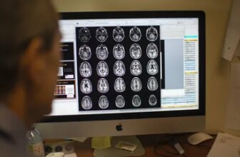 MRI Scans Might Reveal Signs of Alzheimer's Disease Seven Years Before a Telltale Marker Appears in the Brain
