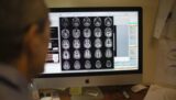 MRI Scans Might Reveal Signs of Alzheimer's Disease Seven Years Before a Telltale Marker Appears in the Brain